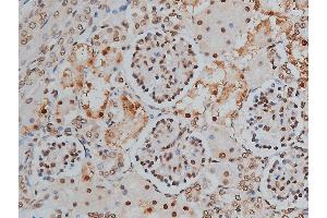 ABIN6268991 at 1/200 staining human kidney tissue sections by IHC-P. (PPP1R12A Antikörper  (pThr853))