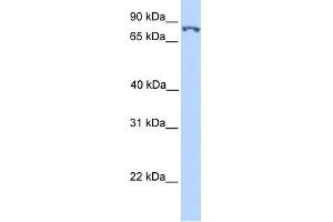 WB Suggested Anti-SSRP1 Antibody Titration:  0. (SSRP1 Antikörper  (N-Term))
