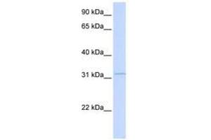 Image no. 1 for anti-Retinol Dehydrogenase 12 (All-Trans/9-Cis/11-Cis) (RDH12) (AA 179-228) antibody (ABIN6741205) (RDH12 Antikörper  (AA 179-228))