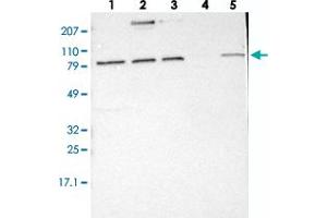 Western blot analysis of Lane 1: RT-4, Lane 2: EFO-21, Lane 3: A-431, Lane 4: Liver, Lane 5: Tonsil with ELFN2 polyclonal antibody  at 1:250-1:500 dilution.
