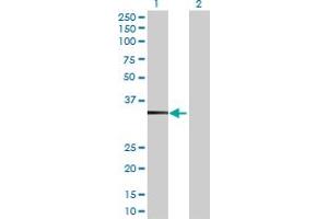 Western Blot analysis of TBC1D21 expression in transfected 293T cell line by TBC1D21 MaxPab polyclonal antibody. (TBC1D21 Antikörper  (AA 1-336))