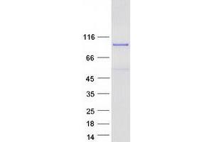 Validation with Western Blot (MED25 Protein (Myc-DYKDDDDK Tag))