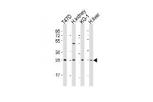 All lanes : Anti-HAVCR2 Antibody (Center) at 1:2000 dilution Lane 1: T47D whole cell lysates Lane 2: human kidney lysates Lane 3: KG-1 whole cell lysates Lane 4: human liver lysates Lysates/proteins at 20 μg per lane. (TIM3 Antikörper  (AA 167-194))