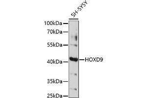 Western blot analysis of extracts of SH-SY5Y cells, using HOXD9 antibody (ABIN7267776) at 1:1000 dilution. (HOXD9 Antikörper  (AA 100-200))