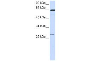 TMEM138 antibody used at 1 ug/ml to detect target protein.
