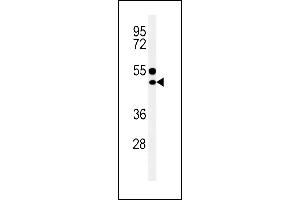 CD1e Antikörper  (AA 184-212)