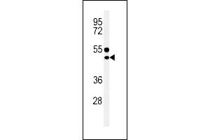 CD1E Antibody (Center) (ABIN653900 and ABIN2843142) western blot analysis in MDA-M cell line lysates (35 μg/lane). (CD1e Antikörper  (AA 184-212))