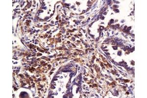 Immunohistochemistry (Paraffin-embedded Sections) (IHC (p)) image for anti-ATP-Binding Cassette, Sub-Family B (MDR/TAP), Member 1B (ABCB1B) (AA 21-100) antibody (ABIN670161)