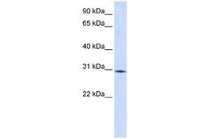 WB Suggested Anti-RBM7 Antibody Titration:  0. (RBM7 Antikörper  (Middle Region))