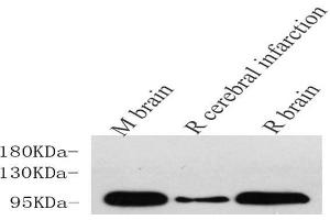 Western Blot analysis of various samples using DLG4 Polyclonal Antibody at dilution of 1:750. (DLG4 Antikörper)