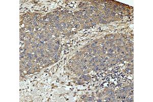 IHC analysis of MEK3 using anti-MEK3 antibody (ABIN3043874).