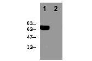 Image no. 1 for anti-Perforin 1 (Pore Forming Protein) (PRF1) antibody (ABIN187561) (Perforin 1 Antikörper)