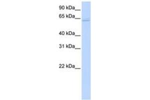 Image no. 1 for anti-TNF Receptor-Associated Factor 6 (TRAF6) (C-Term) antibody (ABIN6742184) (TRAF6 Antikörper  (C-Term))