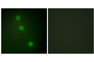 Immunofluorescence analysis of HUVEC cells, using ATF1 antibody.
