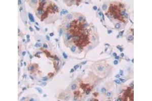 IHC-P analysis of Human Tissue, with DAB staining. (alpha Defensin 1 Antikörper  (AA 20-94))