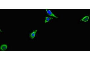 Immunofluorescent analysis of Hela cells using ABIN7143102 at dilution of 1:100 and Alexa Fluor 488-congugated AffiniPure Goat Anti-Rabbit IgG(H+L) (ACTR3 Antikörper  (AA 352-409))