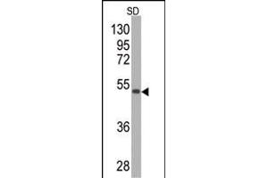 Western blot analysis of anti-SOD2 Monoclonal Antibody (ABIN387807 and ABIN2843901) by SOD2-GST fusion protein (GST MW=26 kD. (SOD2 Antikörper)