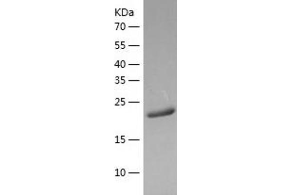 RAB32 Protein (AA 1-225) (His tag)