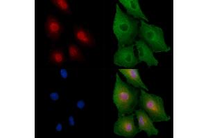 ABIN6258408 and ABIN6275691 staining  cells by IF/ICC. (ZNF420 Antikörper  (Internal Region))