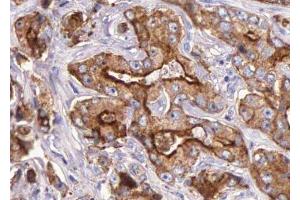 ABIN6276035 at 1/100 staining human Prostate tissue sections by IHC-P. (GPR35 Antikörper  (Internal Region))