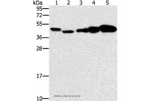Western blot analysis of Hela, Raji, Jurkat, A549 and NIH/3T3 cell, using PPAT Polyclonal Antibody at dilution of 1:250 (PPAT Antikörper)