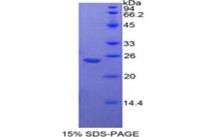 SDS-PAGE analysis of Mouse Insulin Like Growth Factor Binding Protein 7 (IGFBP7) Protein. (IGFBP7 Protein)