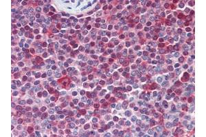 Human Spleen (formalin-fixed, paraffin-embedded) stained with PARP1followed by biotinylated goat anti-rabbit IgG secondary antibody, alkaline phosphatase-streptavidin and chromogen. (PARP1 Antikörper  (N-Term))