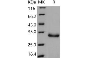 Western Blotting (WB) image for Protease, serine, 2 (Trypsin 2) (PRSS2) (Active) protein (His tag) (ABIN7197544) (PRSS2 Protein (His tag))