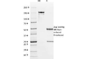 SDS-PAGE Analysis Purified HPV-16 Mouse Monoclonal Antibody (HPV16/1295). (HPV16 Antikörper)