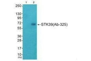 Western blot analysis of extracts from HeLa cells (Lane 2), using STK39 (Ab-325) antiobdy. (STK39 Antikörper  (Ser325))
