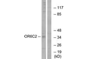 Western blot analysis of extracts from HT-29 cells, using OR6C2 Antibody. (OR6C2 Antikörper  (AA 231-280))