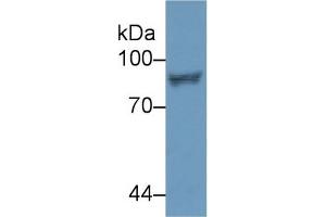Western Blot; Sample: Human Jurkat cell lysate; Primary Ab: 2µg/ml Rabbit Anti-Human STAT4 Antibody Second Ab: 0. (STAT4 Antikörper  (AA 505-737))