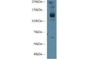Western blot analysis of Pig Skeletal muscle lysate, using Human LIFR Antibody (1 µg/ml) and HRP-conjugated Goat Anti-Rabbit antibody ( (LIFR Antikörper  (AA 692-833))