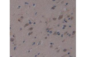 Used in DAB staining on fromalin fixed paraffin- embedded brain tissue (AHRR Antikörper  (AA 1-182))