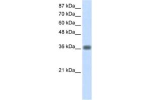 Western Blotting (WB) image for anti-Kelch Domain Containing 8A (KLHDC8A) antibody (ABIN2462280) (KLHDC8A Antikörper)