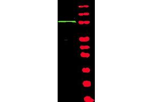Western blot using Affinity Purified anti-BACH1 antibody shows detection of a band at ~105 kDa (lane 1) corresponding to human BACH1 present in a 293 whole cell lysate (arrowhead). (BRIP1 Antikörper  (Isoform 1))