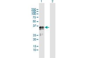 Western Blot analysis of SGCG expression in transfected 293T cell line by SGCG MaxPab polyclonal antibody.
