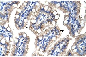 Human Intestine (ZNF785 Antikörper  (C-Term))