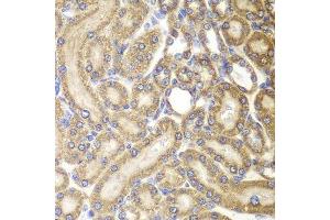 Immunohistochemistry (Paraffin-embedded Sections) (IHC (p)) image for anti-Heat Shock 60kDa Protein 1 (Chaperonin) (HSPD1) (AA 27-240) antibody (ABIN3021182)