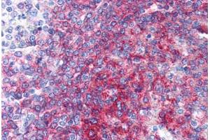 Human Spleen (formalin-fixed, paraffin-embedded) stained with CD40 antibody ABIN337317 at 10 ug/ml followed by biotinylated anti-mouse IgG secondary antibody ABIN481714, alkaline phosphatase-streptavidin and chromogen. (CD40 Antikörper)