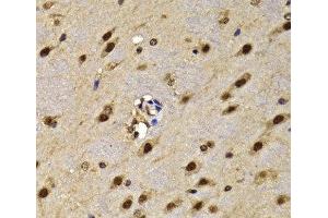 Immunohistochemistry of paraffin-embedded Mouse brain using HMG20A Polyclonal Antibody at dilution of 1:100 (40x lens). (HMG20A Antikörper)