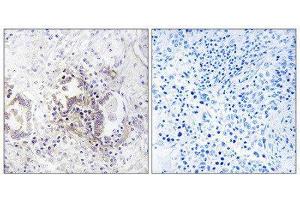 Immunohistochemistry (IHC) image for anti-Choroideremia-Like (Rab Escort Protein 2) (CHML) (Internal Region) antibody (ABIN1851922)