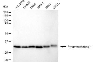 Western blotting analysis using Pyrophosphatase 1 antibody (ABIN7800077).