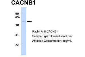 Host:  Rabbit  Target Name:  CACNB1  Sample Type:  Human Fetal Liver  Antibody Dilution:  1. (CACNB1 Antikörper  (N-Term))