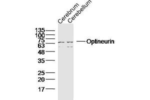 Lane 1: Mouse Cerebrum lysates; Lane 2: Mouse cerebellum; probed with Optineurin Polyclonal Antibody, unconjugated (bs-13658R) at 1:300 overnight at 4°C followed by a conjugated secondary antibody for 60 minutes at 37°C. (OPTN Antikörper  (AA 341-440))