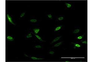 Immunofluorescence of monoclonal antibody to CDC2L6 on HeLa cell. (CDK19 Antikörper  (AA 367-467))