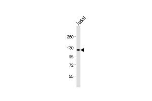Anti-PRDM16 Antibody (Center) at 1:2000 dilution + Jurkat whole cell lysate Lysates/proteins at 20 μg per lane. (PRDM16 Antikörper  (AA 771-804))