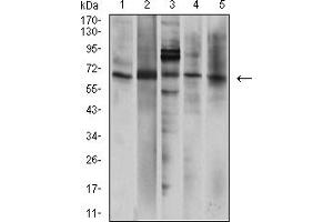 Western Blotting (WB) image for anti-Purinergic Receptor P2X, Ligand-Gated Ion Channel, 7 (P2RX7) (AA 226-452) antibody (ABIN5929932) (P2RX7 Antikörper  (AA 226-452))