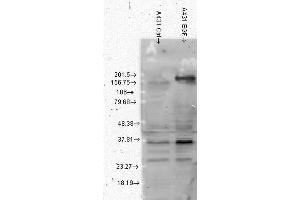 Western Blot analysis of Human A431 cell lysates showing detection of Phosphotyrosine protein using Mouse Anti-Phosphotyrosine Monoclonal Antibody, Clone G104 . (Phosphotyrosine Antikörper  (Biotin))