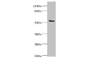 Western blot All lanes: ALG1 antibody at 10 μg/mL + Hela whole cell lysate Secondary Goat polyclonal to rabbit IgG at 1/10000 dilution Predicted band size: 53, 41 kDa Observed band size: 53 kDa (ALG1 Antikörper  (AA 215-464))